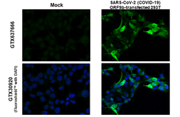 Anti-SARS-CoV-2 (COVID-19) ORF9b antibody [HL1917] used in Immunocytochemistry/ Immunofluorescence (ICC/IF). GTX637666